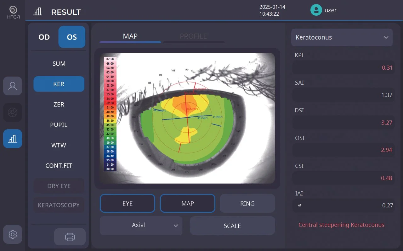 Huvitz HTG-1 Corneal Topographer