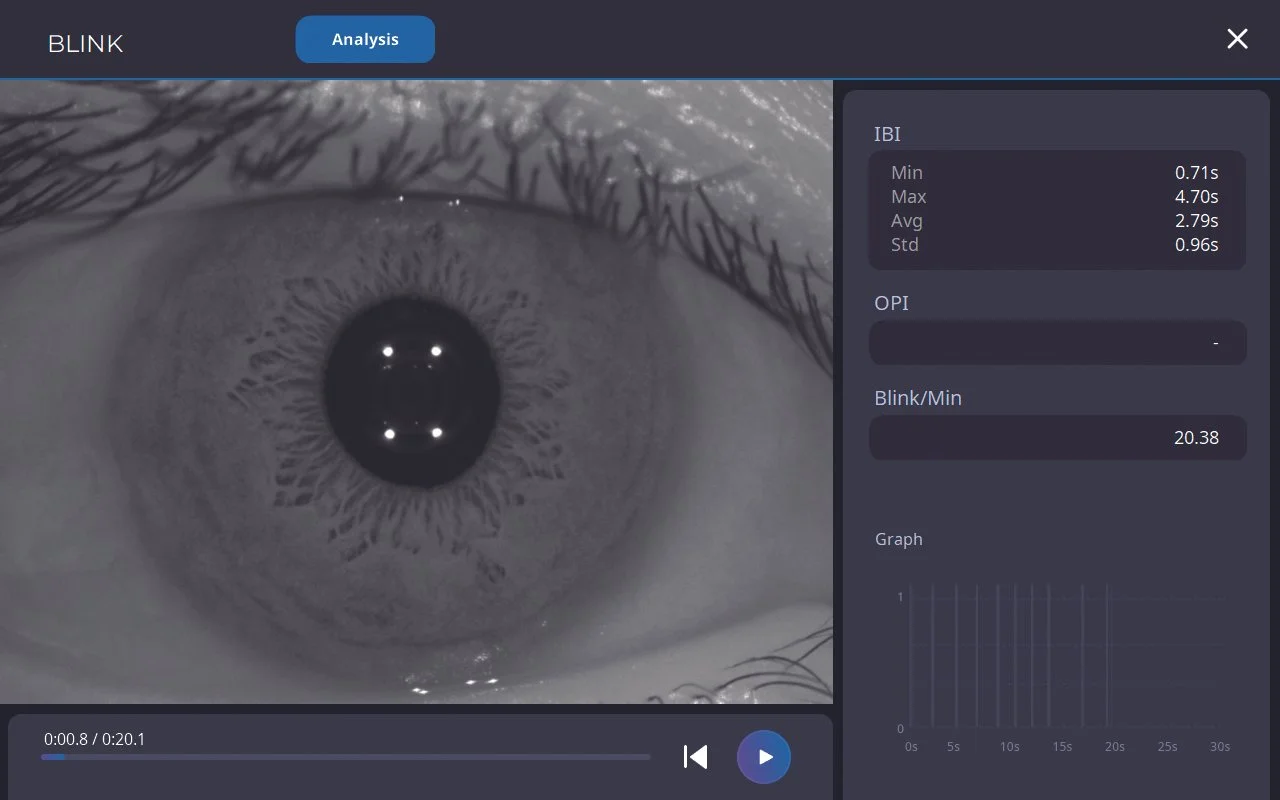 Huvitz HTG-1 Corneal Topographer