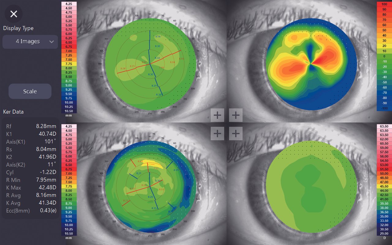Huvitz HTG-1 Corneal Topographer