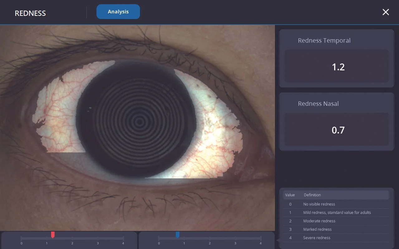 Huvitz HTG-1 Corneal Topographer