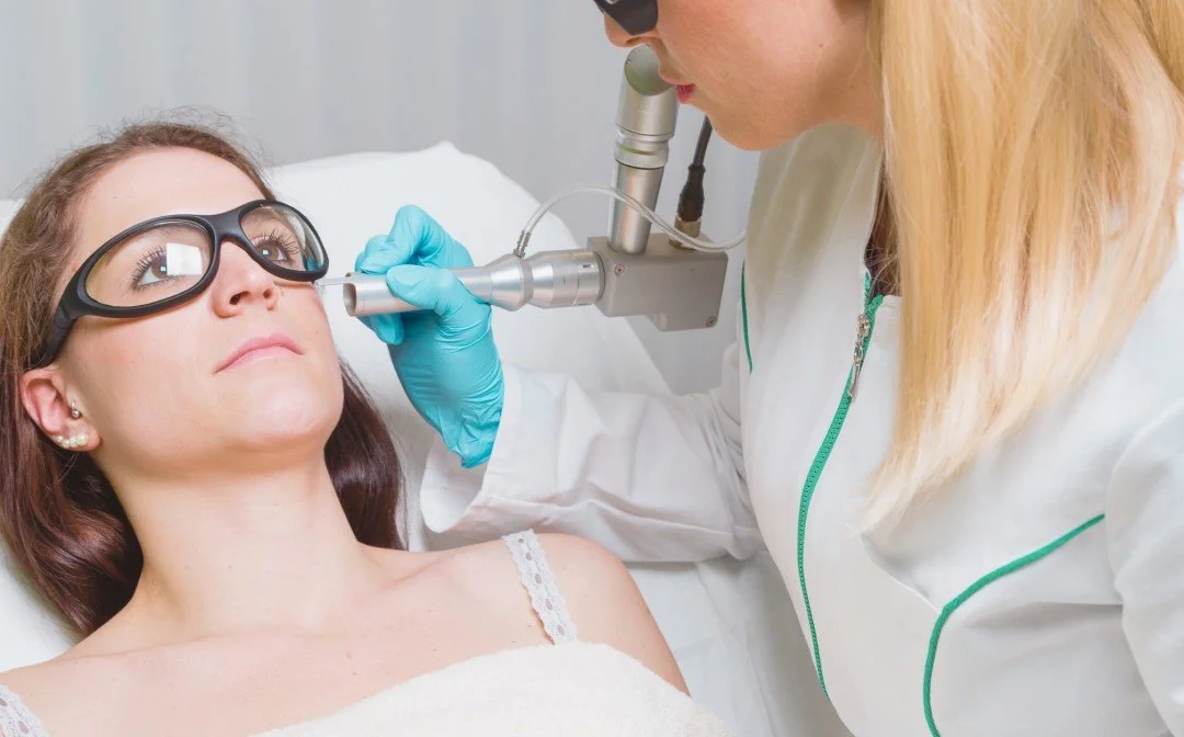 How To Treat Sunspots – Everything You Need To Know