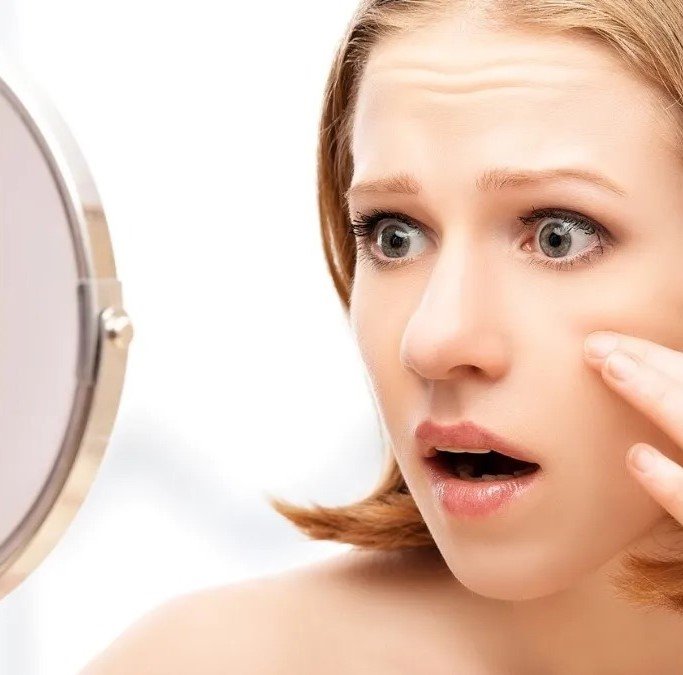 “How Do I Get Rid Of A Blemish Fast?”