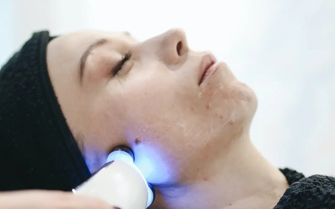 LED Facial – Does it Really Work?