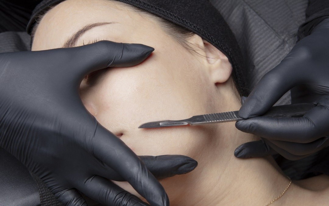 Dermaplaning 101: A Simple Procedure That Can Change Your Skin Forever
