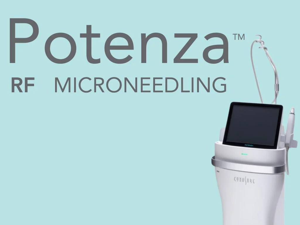Potenza RF Microneedling: Benefits for Skin Tightening, Acne Scars &amp; Stretch Marks