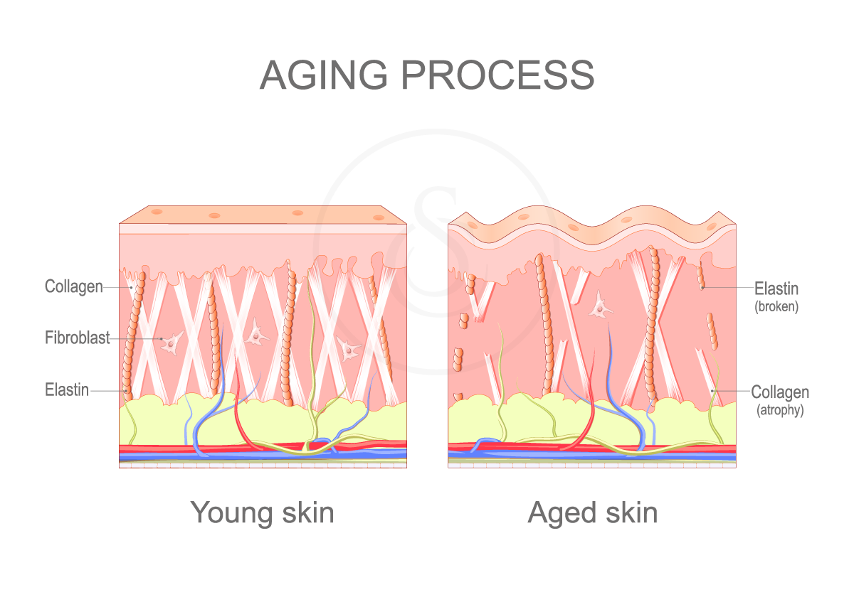5 Signs Your Skin Is Losing Collagen (and What You Can Do About It)