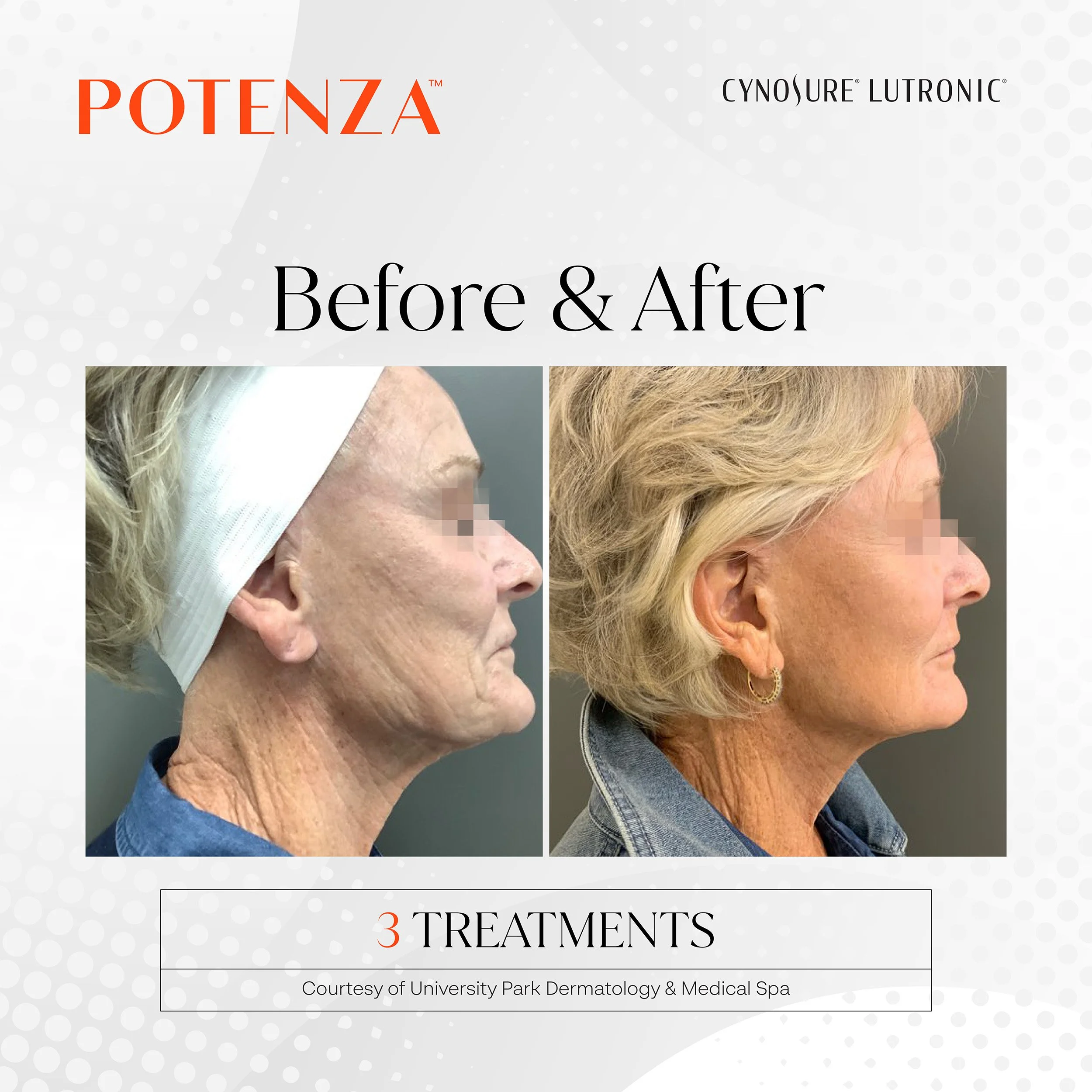 How Do I Know If I Need Filler, Botox, or Skin Tightening?