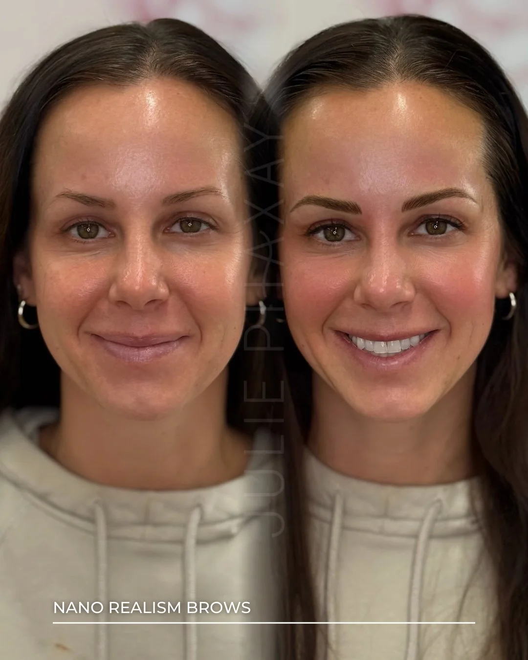 Why Nano Brows Are Replacing Microblading in Minneapolis