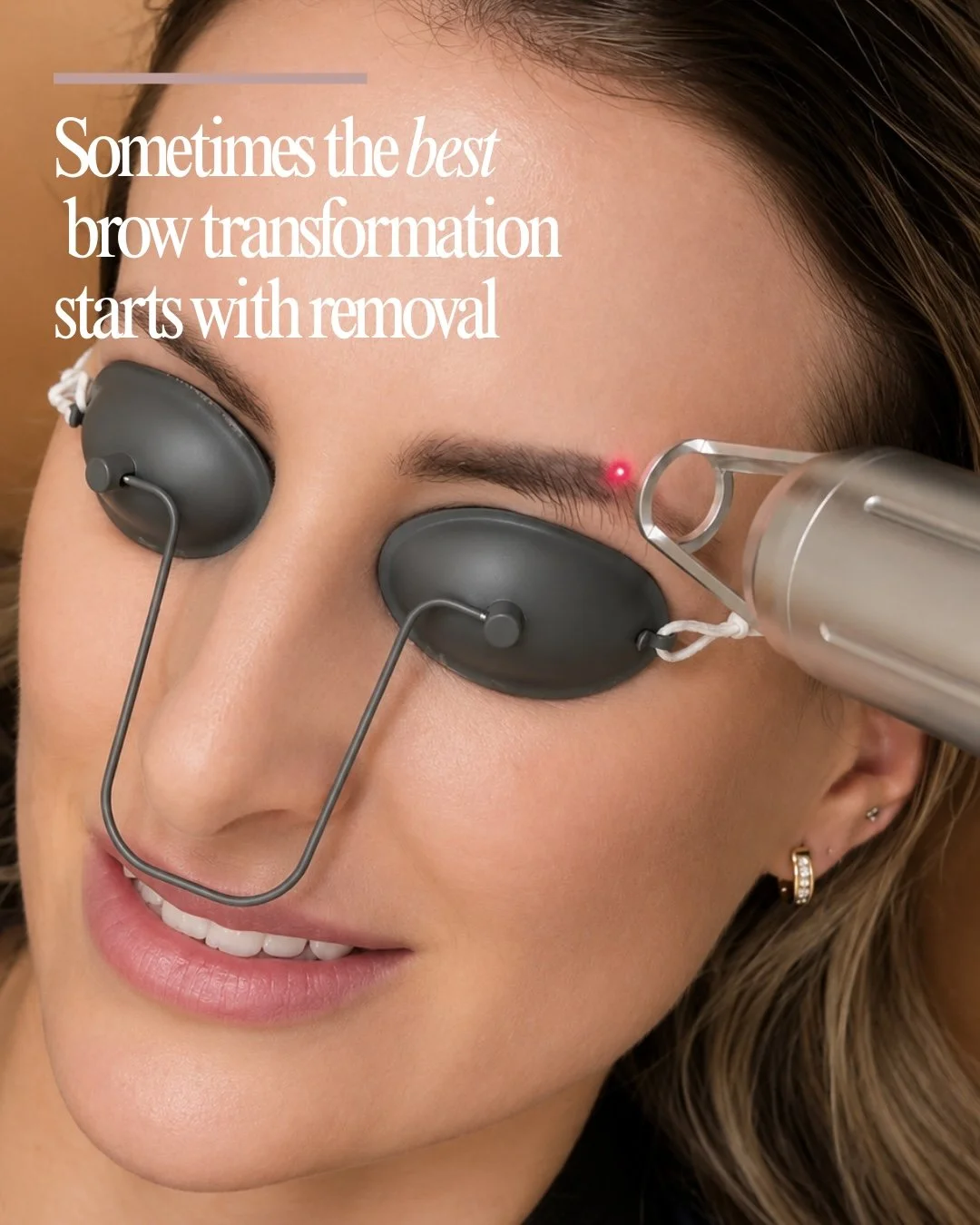Why Everyone Waits Too Long to Laser Off Their Old Microblading (And Wishes They Hadn't)