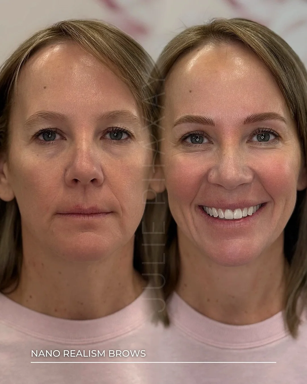 That smile is not a coincidence 💗

Brows change your face. Not in a dramatic, obvious way. In a way where suddenly everything is framed, balanced, and you just look like the best version of yourself. That is exactly what happened here.

Nano Realism