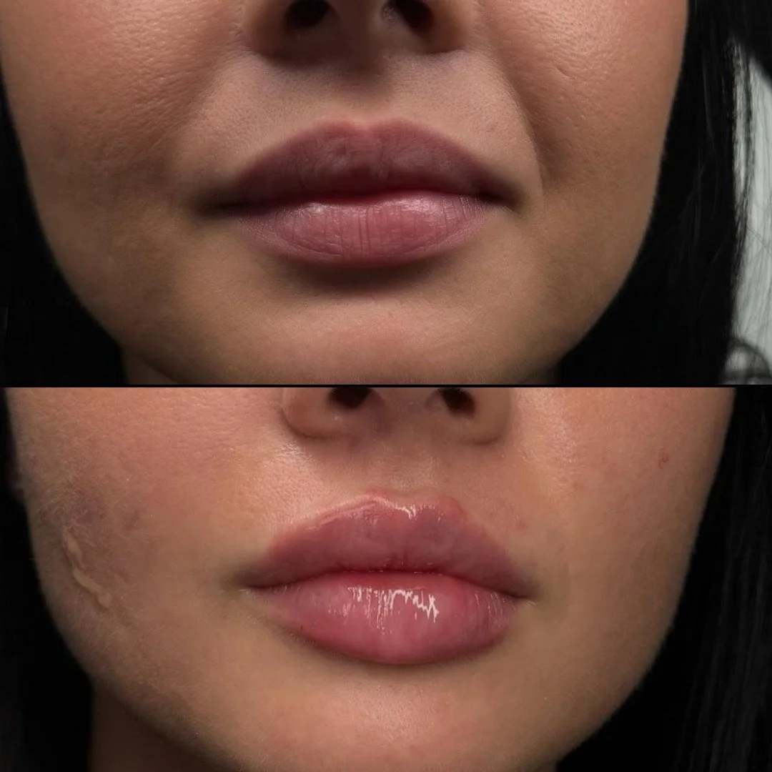 YOU KNOW NKD 2.png.JPG