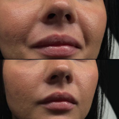 Untitled design-2.png