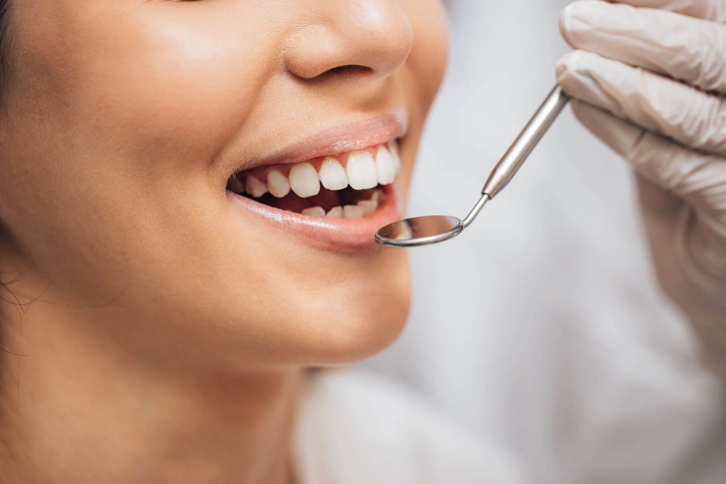 Close-up of a person's smiling face with teeth visible, receiving a dental checkup with a dentist's mirror tool.