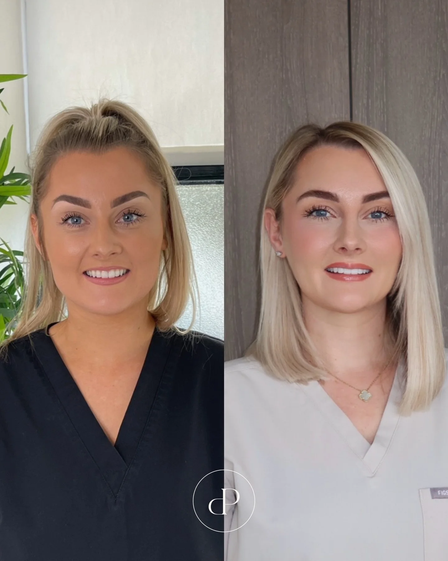 Hi everyone&hellip; Laura here 🤍 just wanted to share a little insight into my treatment journey over the past 5 years&hellip;

My before photo was taken in 2021. I had tried anti-wrinkle injections before, but it wasn&rsquo;t until the lead up to m