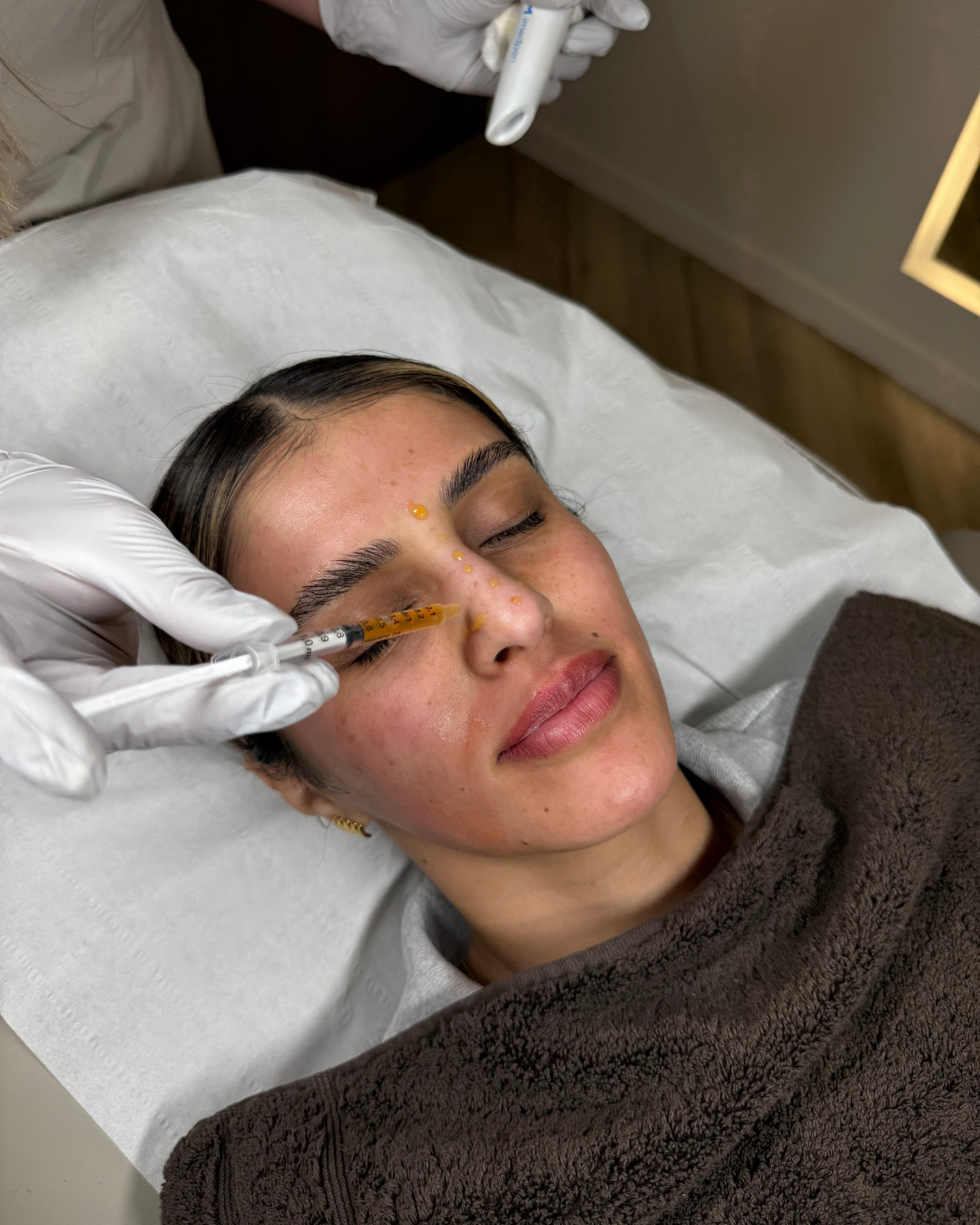 Derma Plus Medical Microneedling With Exsomes  (3).png
