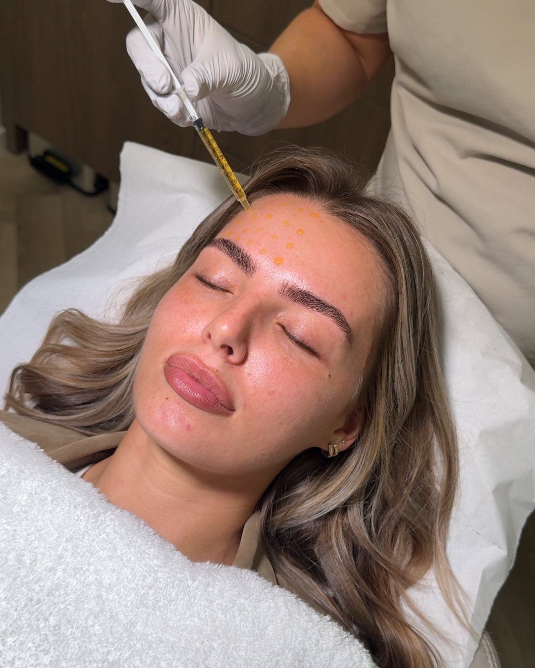 Derma Plus Medical Microneedling With Exsomes .png