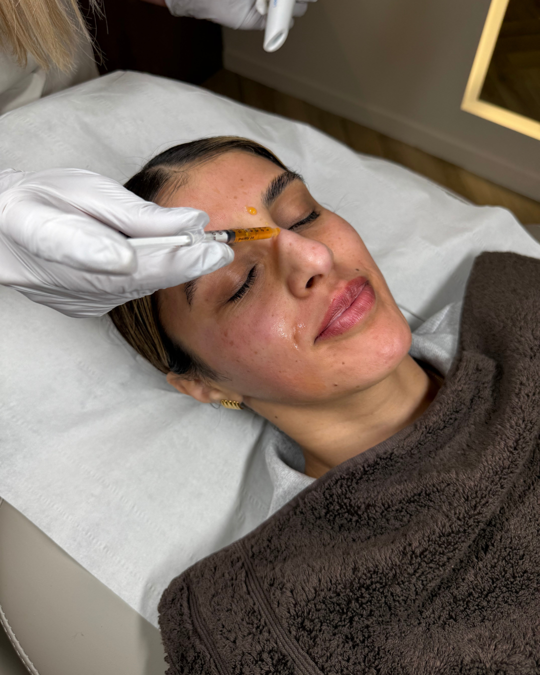 Derma Plus Medical Microneedling With Exsomes  (5).png