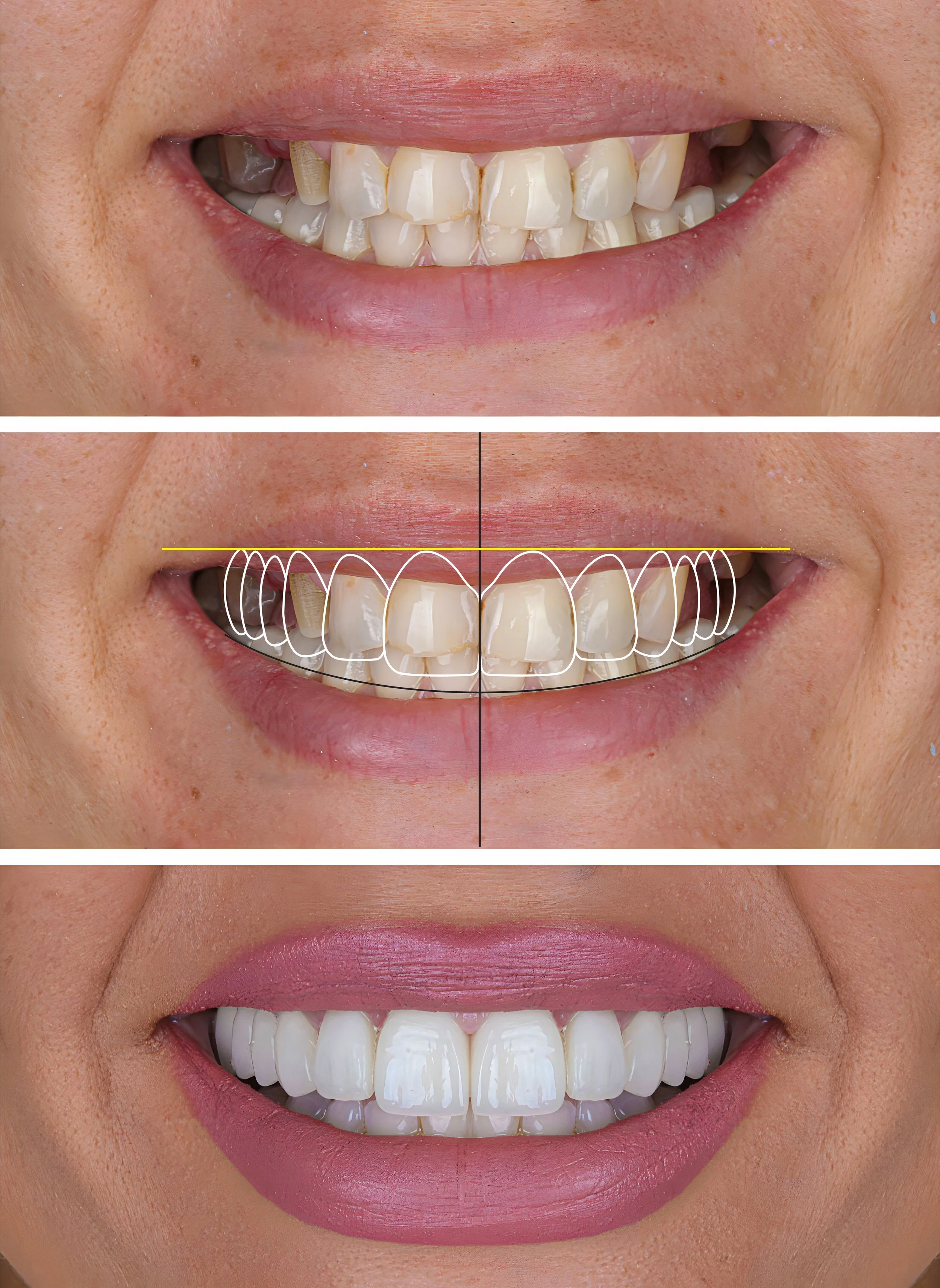 Get the Beautiful Smile You Deserve With Cosmetic Dentistry