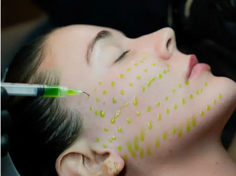 BioRePeel skin rejuvenation treatment at EB Glow in Kirkland