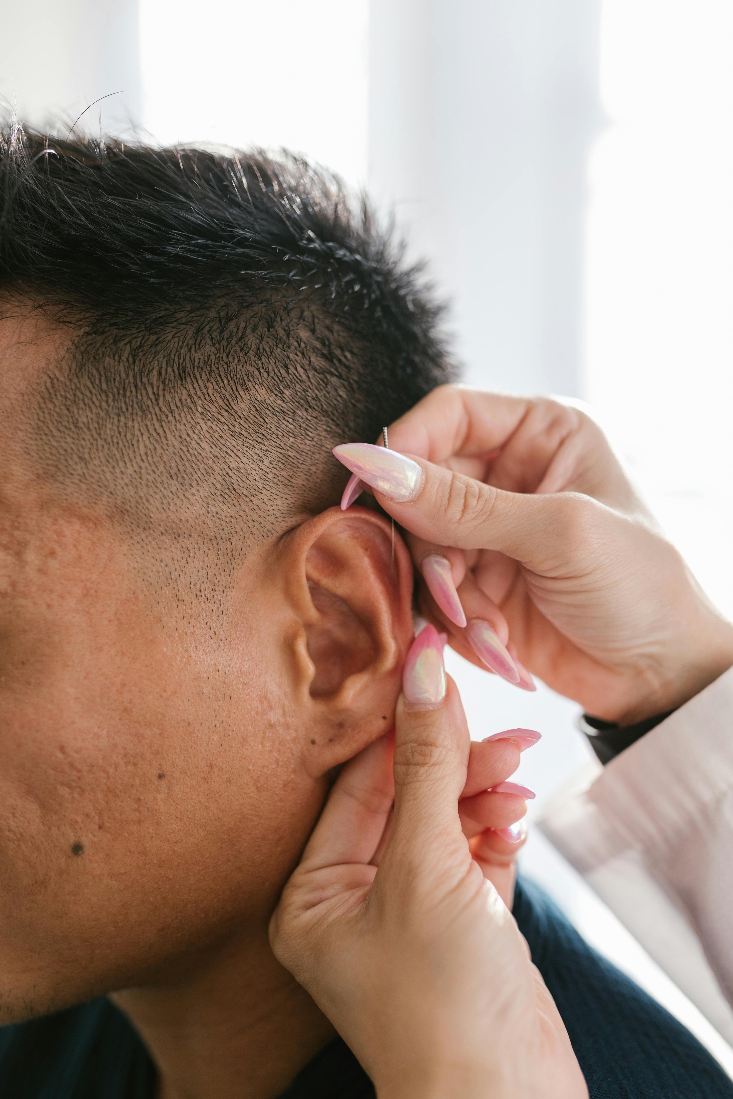 Person receiving acupuncture on the ear