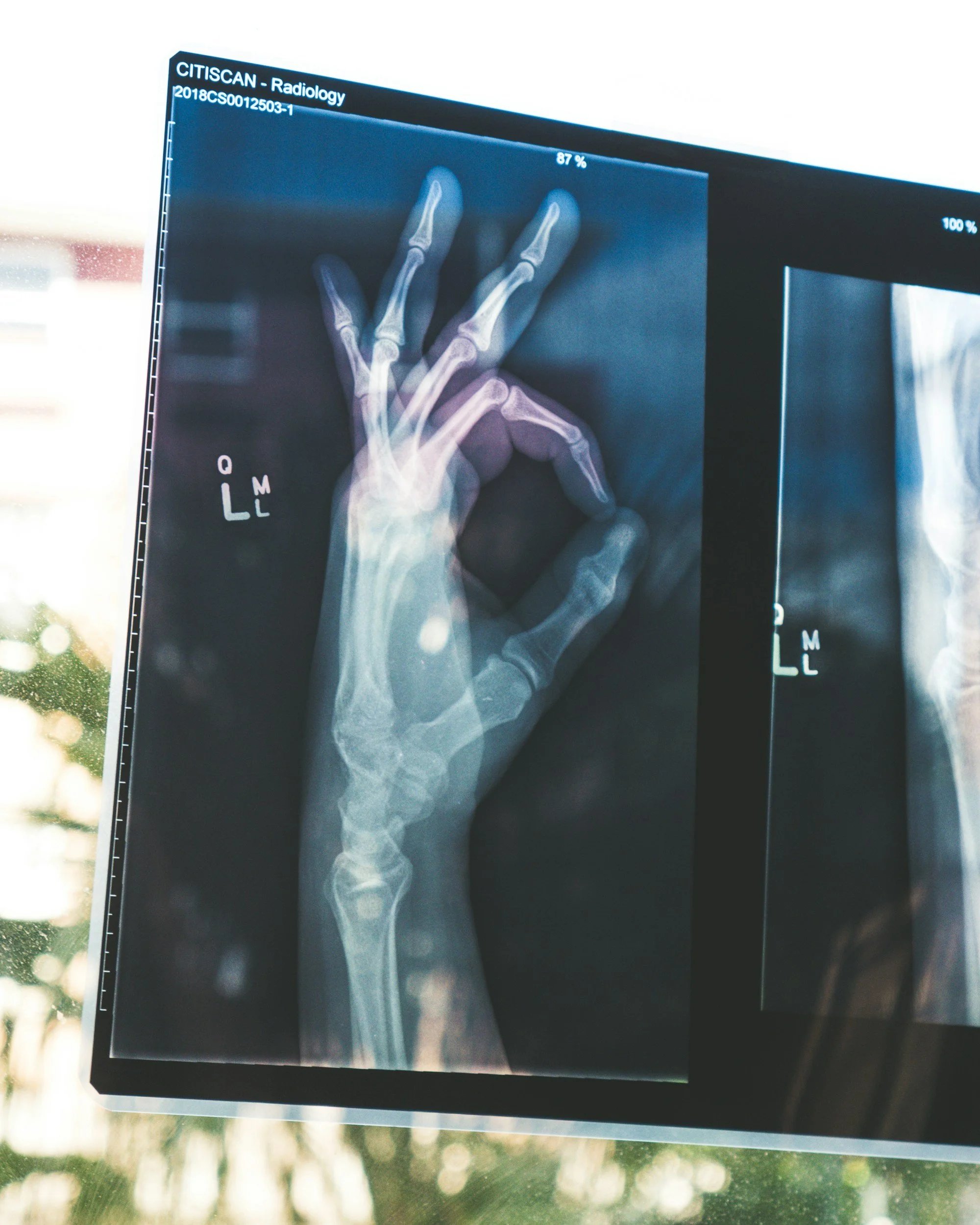 The Problem With Waiting for Imaging Before Starting Rehab