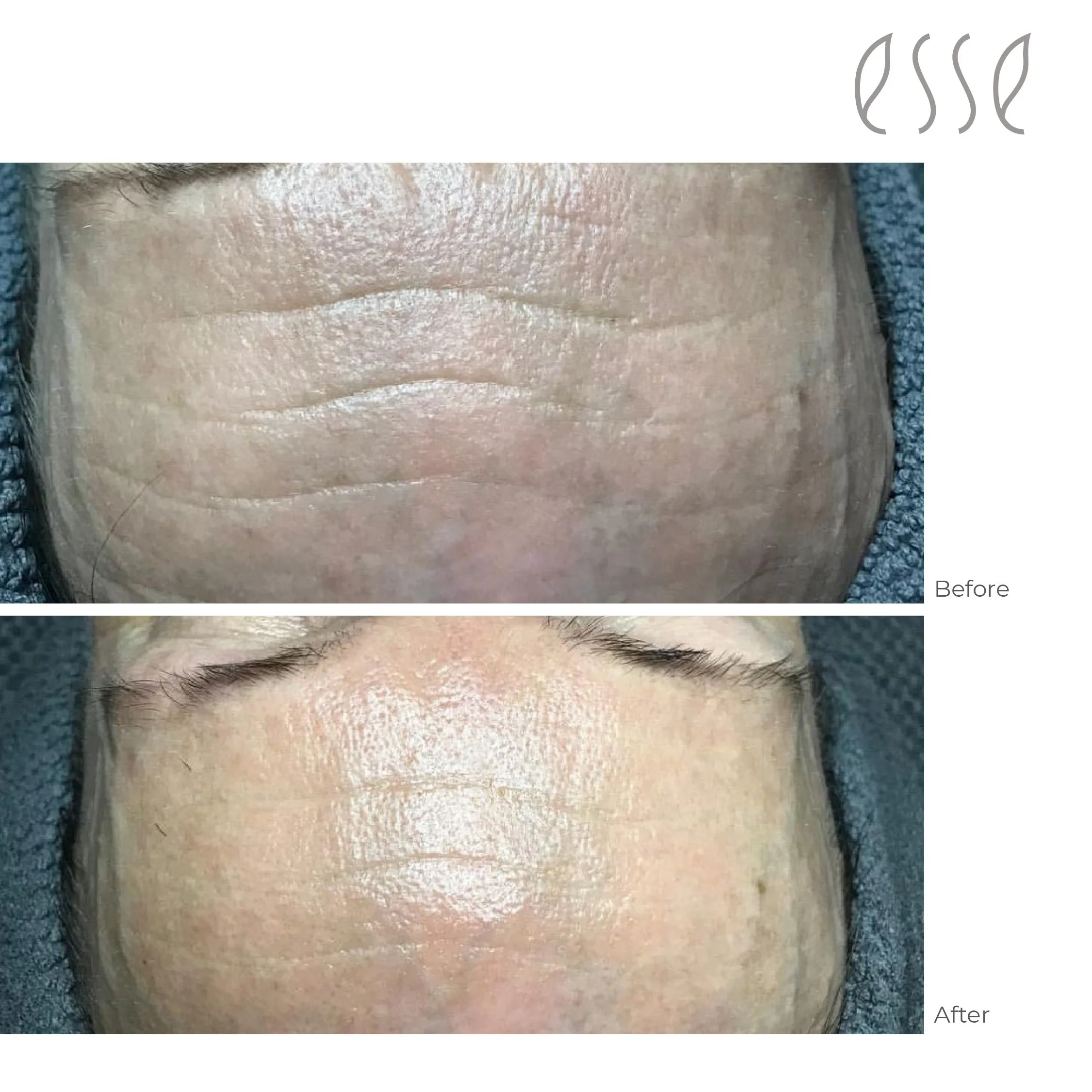 Edu before and after 2022-11.jpg