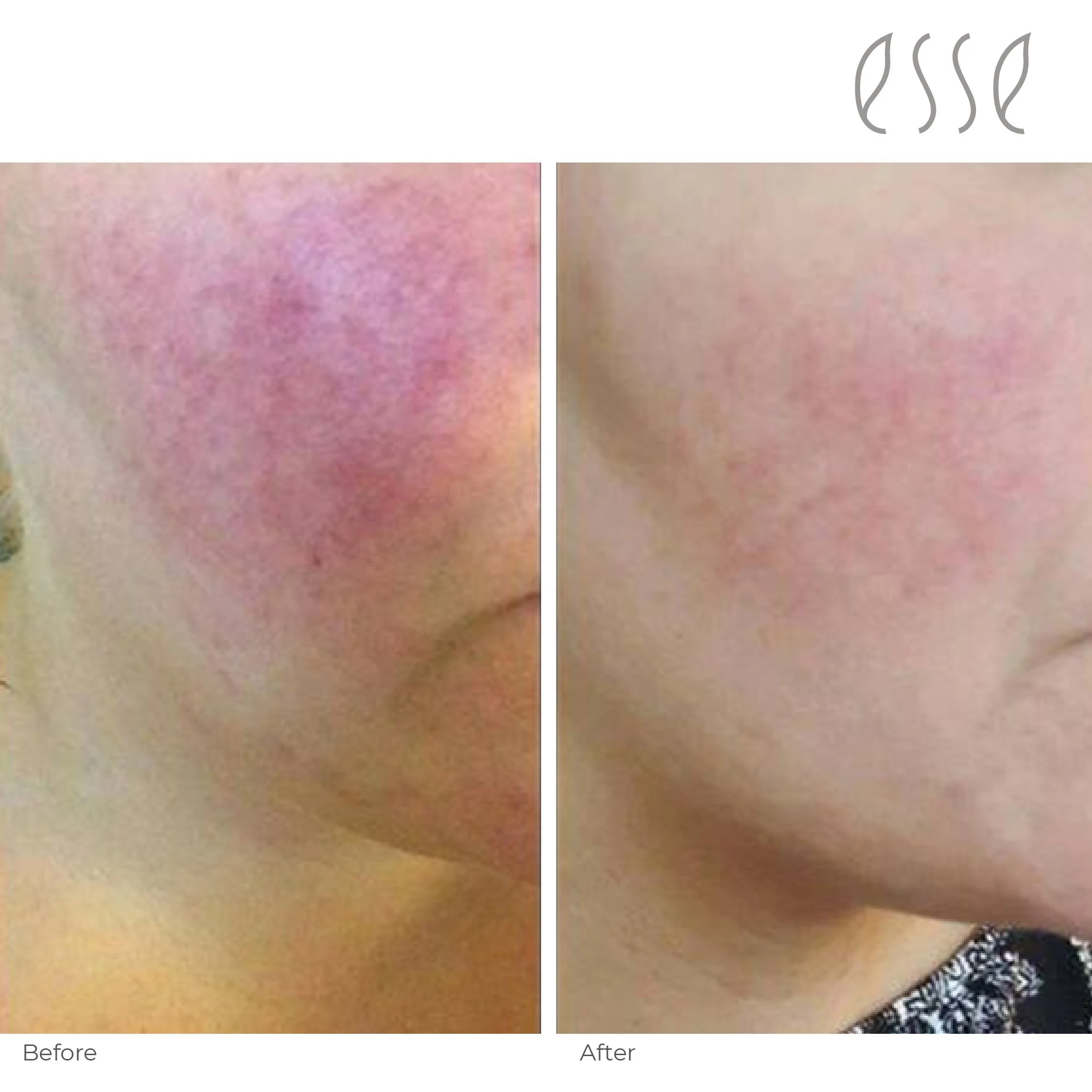 Why your skin changes after 35 (and what most women get wrong).