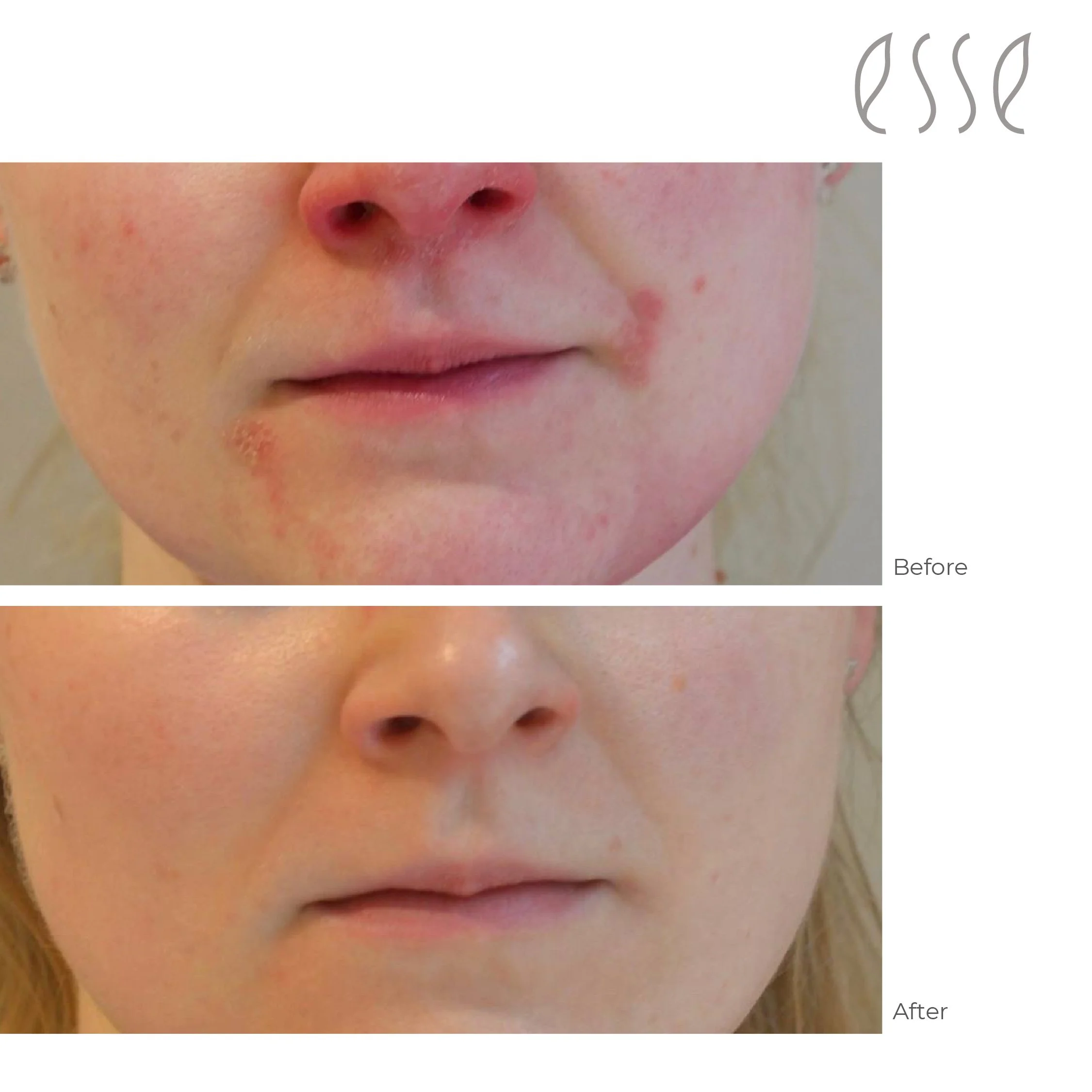 Edu before and after 2022-06.jpg