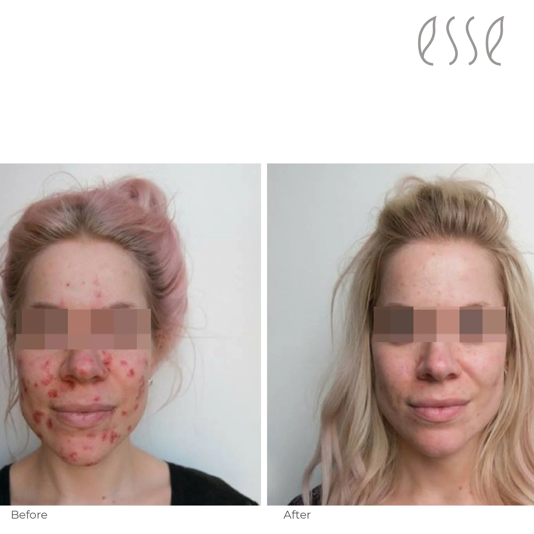 Edu before and after 2022-07.jpg