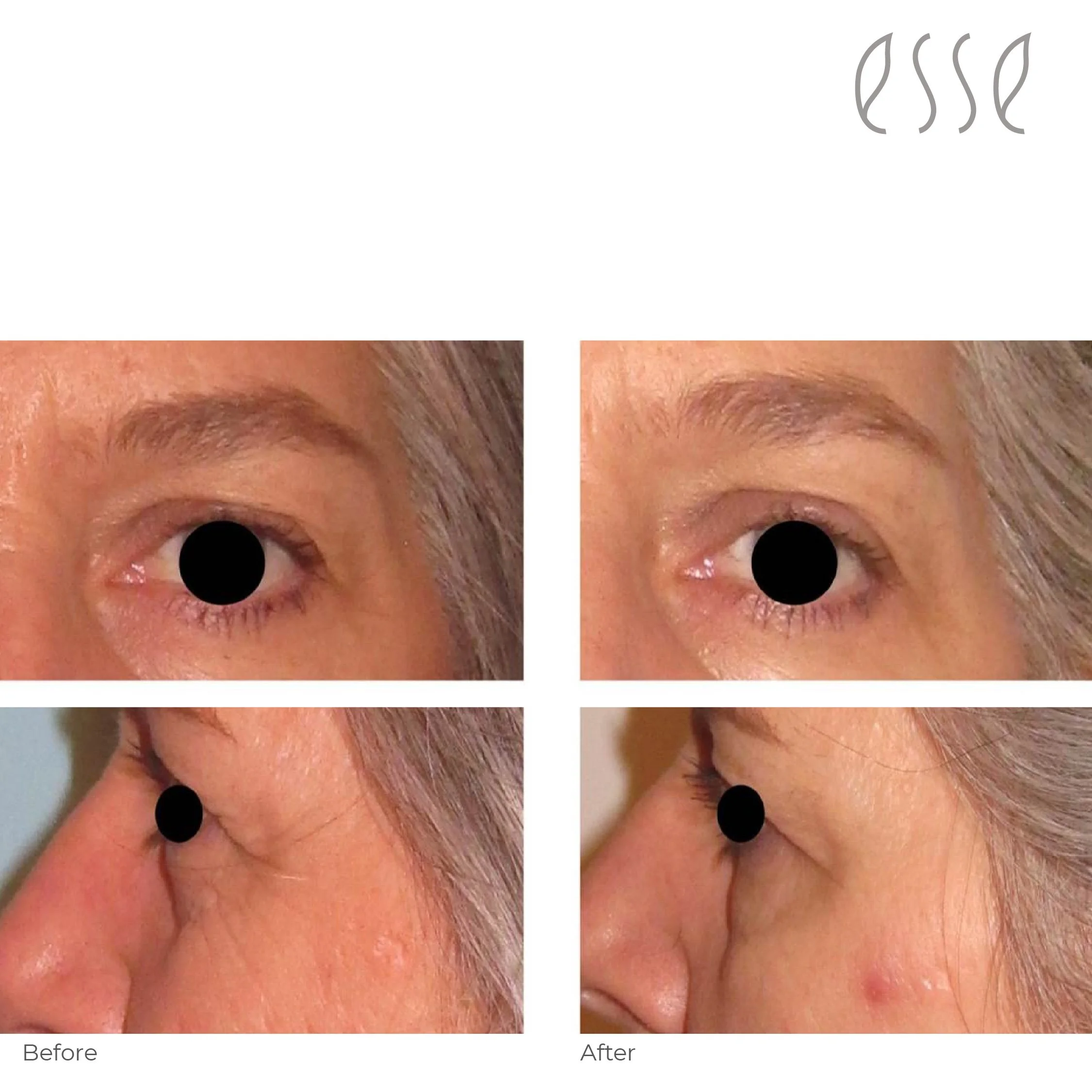 Edu before and after 2022-08.jpg