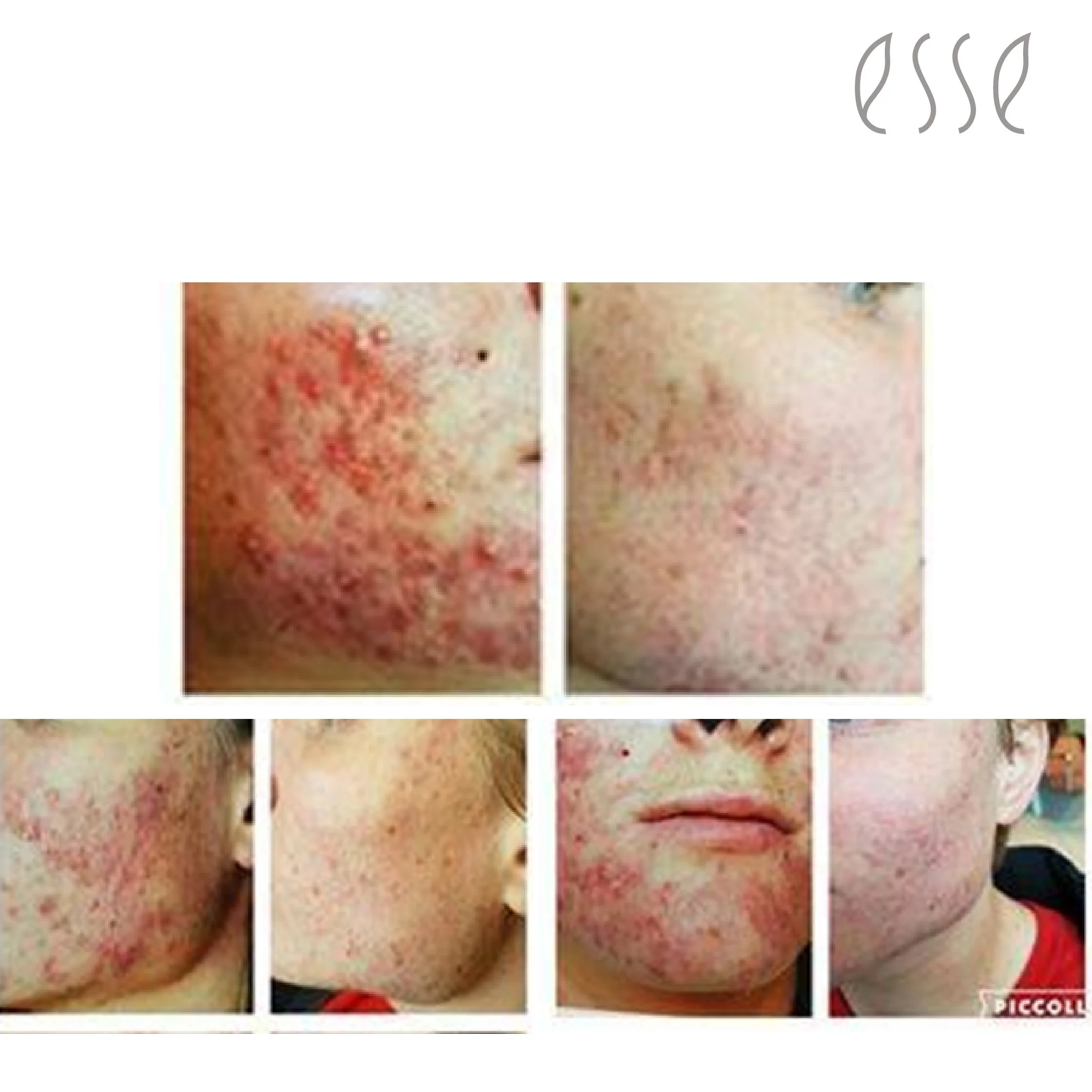 Edu before and after 2022-05.jpg