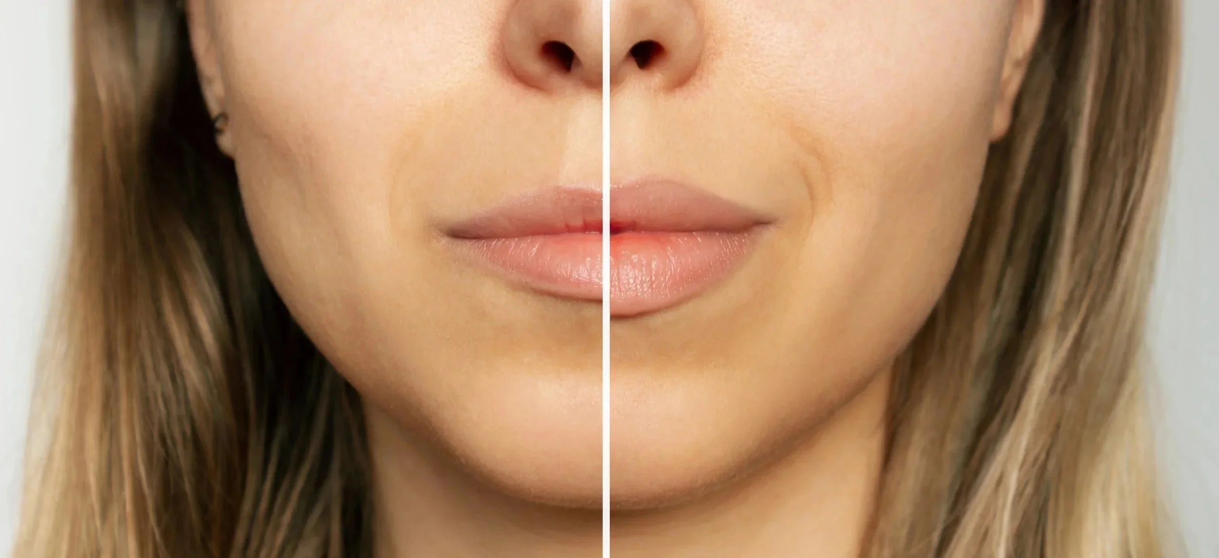 Close-up of a woman's face split into two halves, showing a comparison between skin with signs of aging on the left and youthful, smooth skin on the right.
