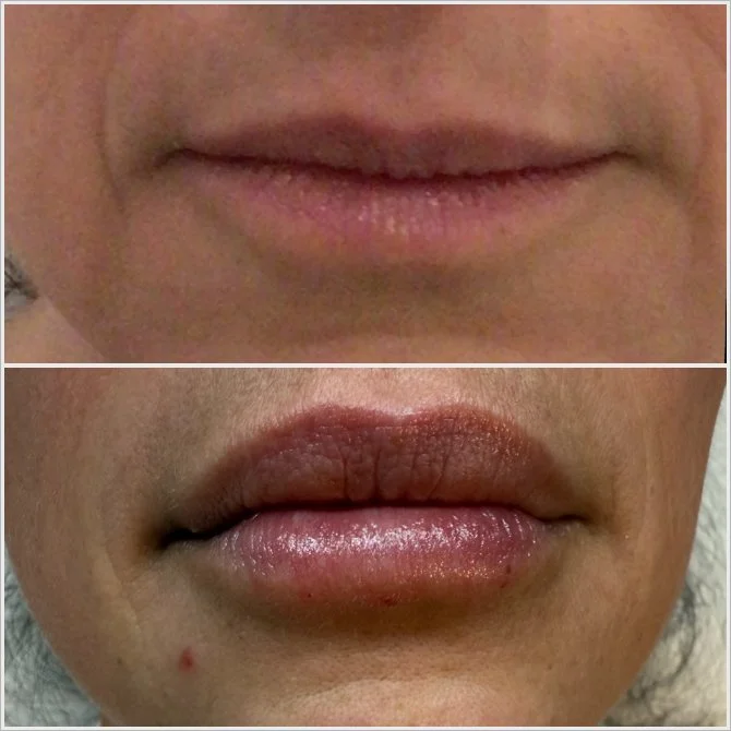 JPEG image-4443-8685-69-0.JPEG