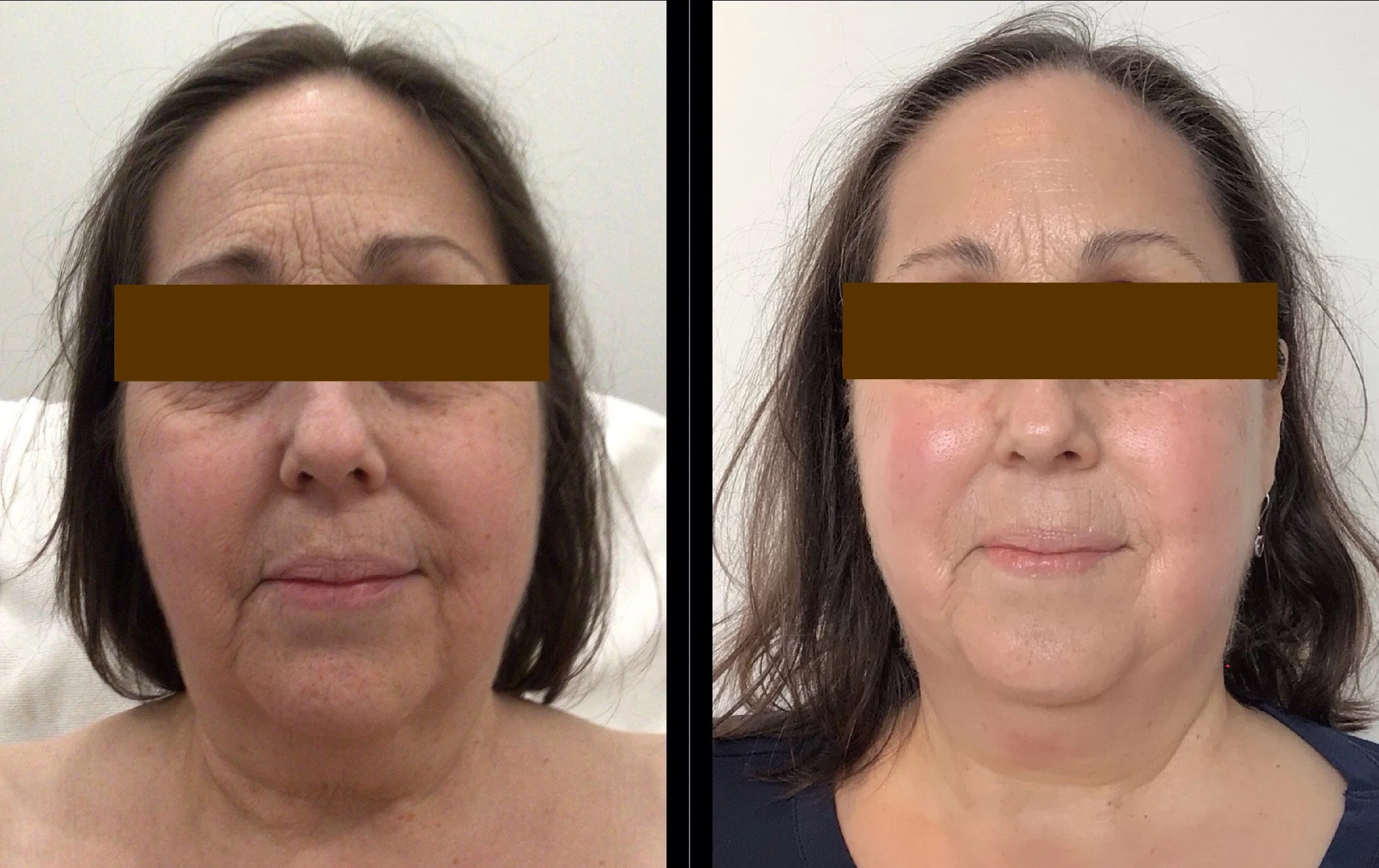 The New Skin Philosophy: Texture, Tone, and Health