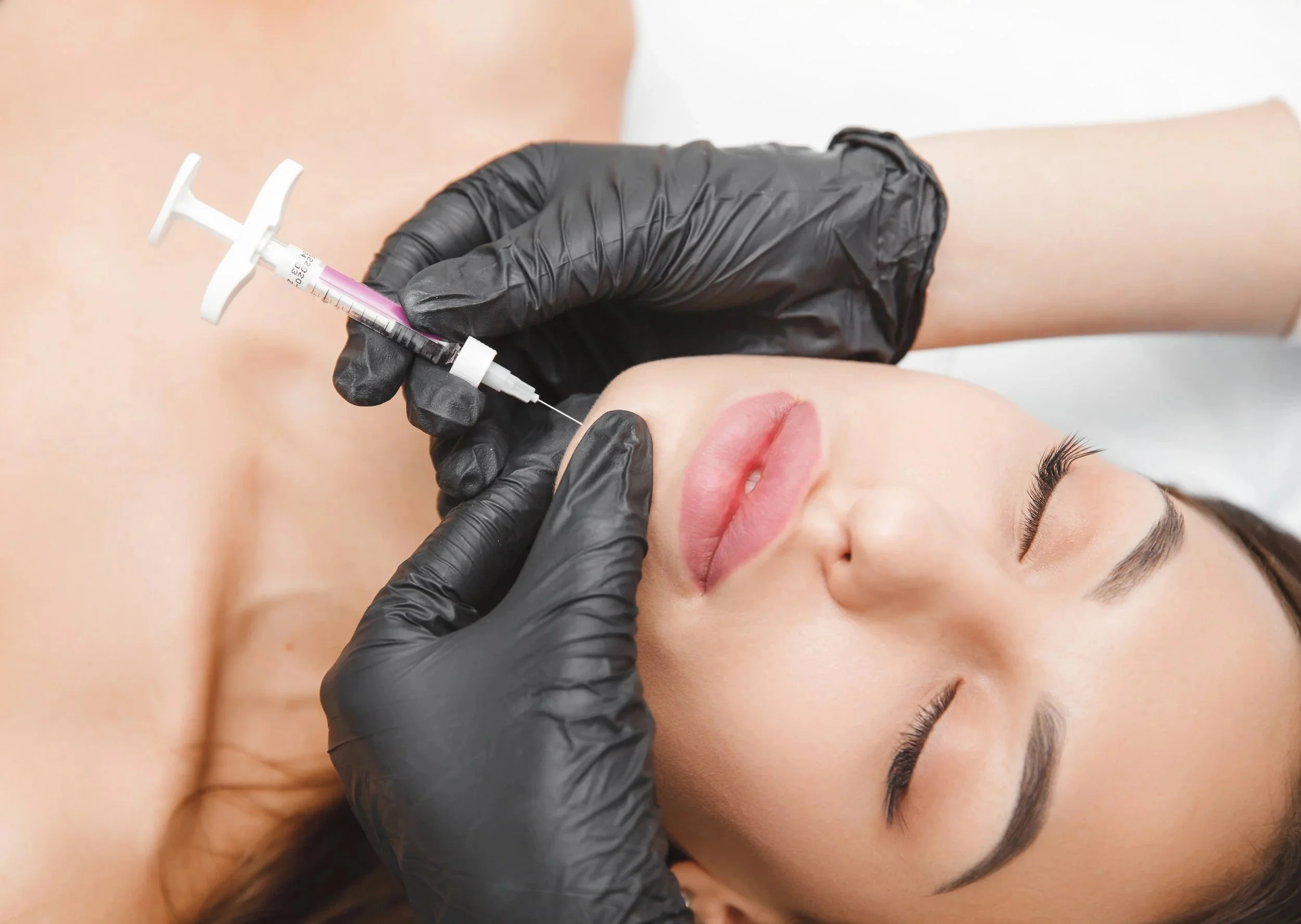 A woman receiving a cosmetic injection in her lips from a healthcare professional wearing black gloves.