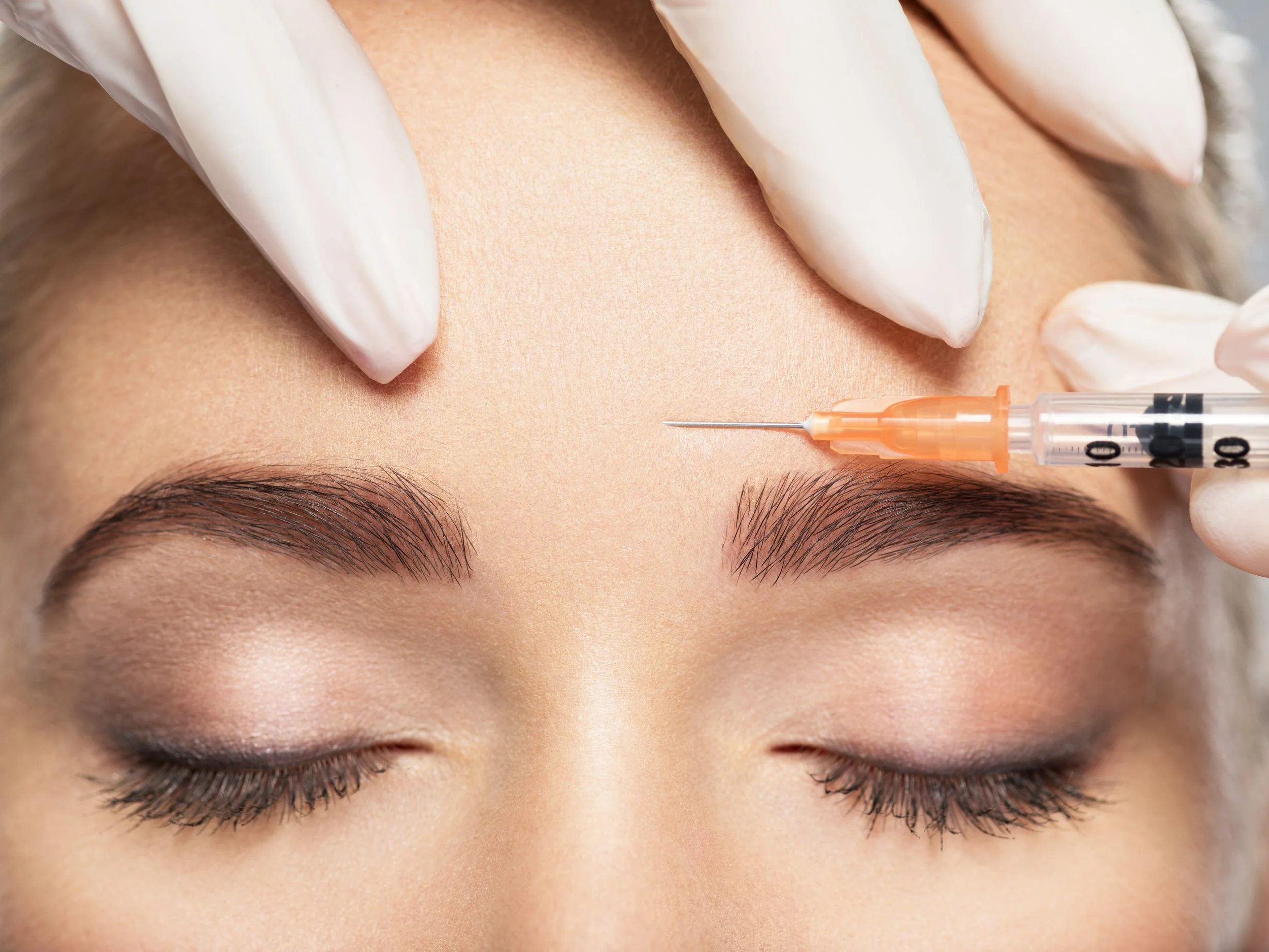A person receiving a cosmetic procedure of Botox on their forehead with a syringe, with closed eyes and gloved hands holding the syringe.