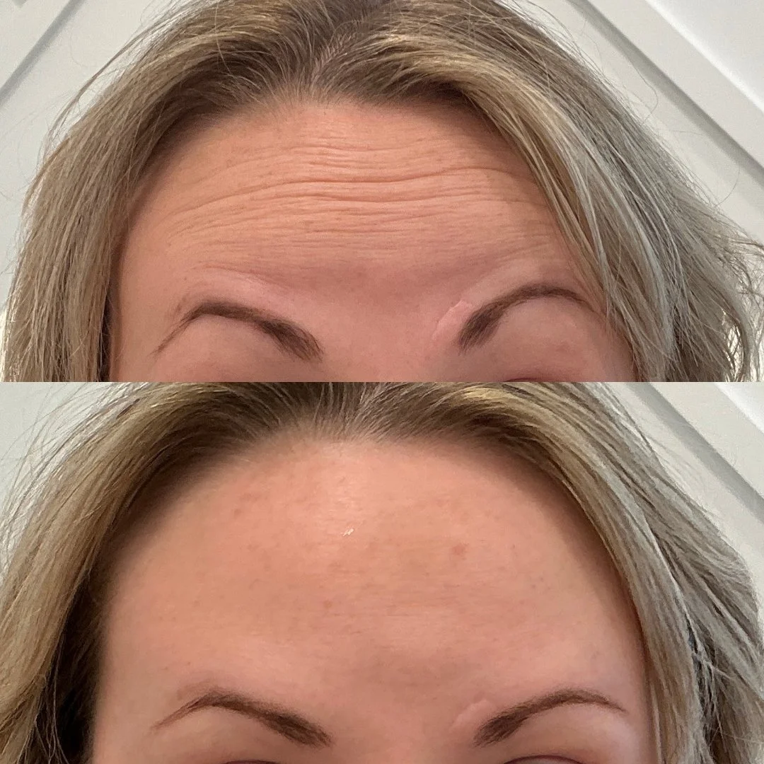 Tox + Filler B&A's .zip - 13.jpeg