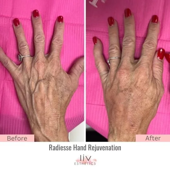 Before after minimal skincare Instagram post.zip - 1.jpeg