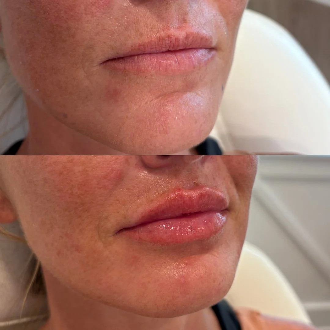 Simple Photocentric Before and After Instagram Post.zip - 4.jpeg