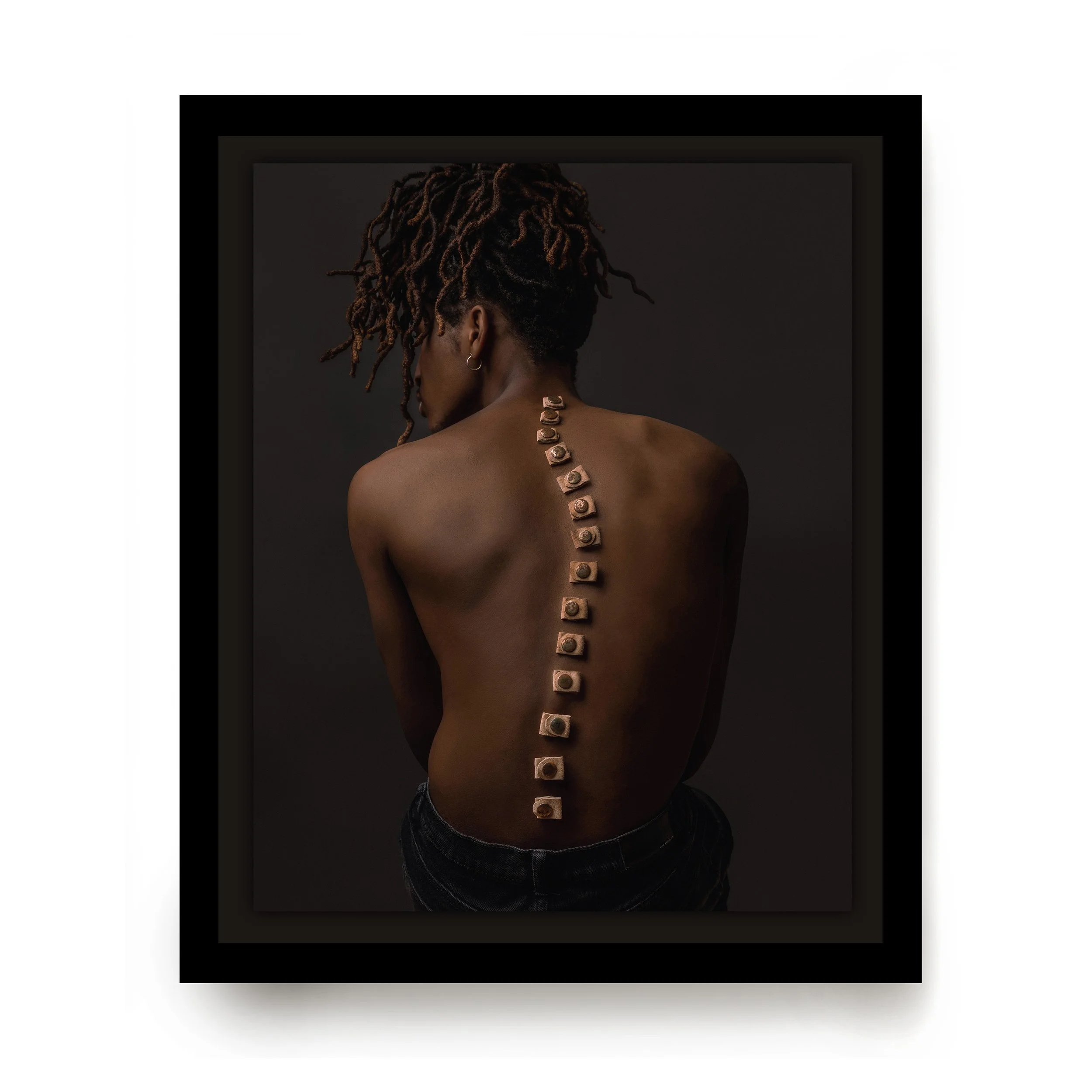 Emmalee Rathsam_Strength In Scoliosis_2.jpg