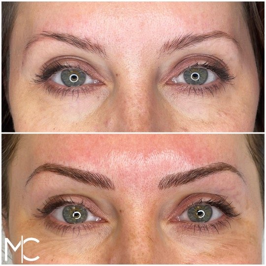 microblading