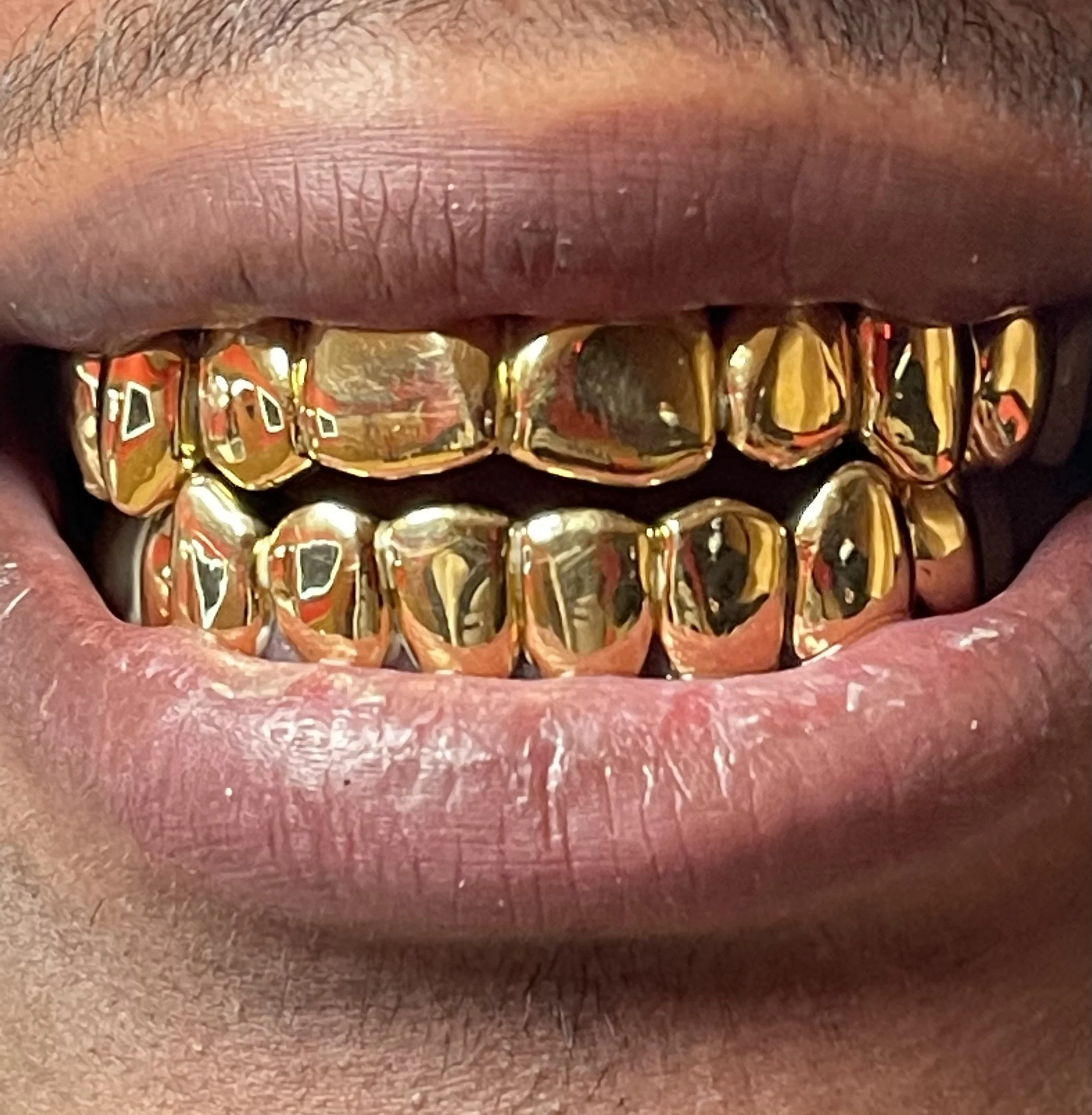 GOLD GRILLZ