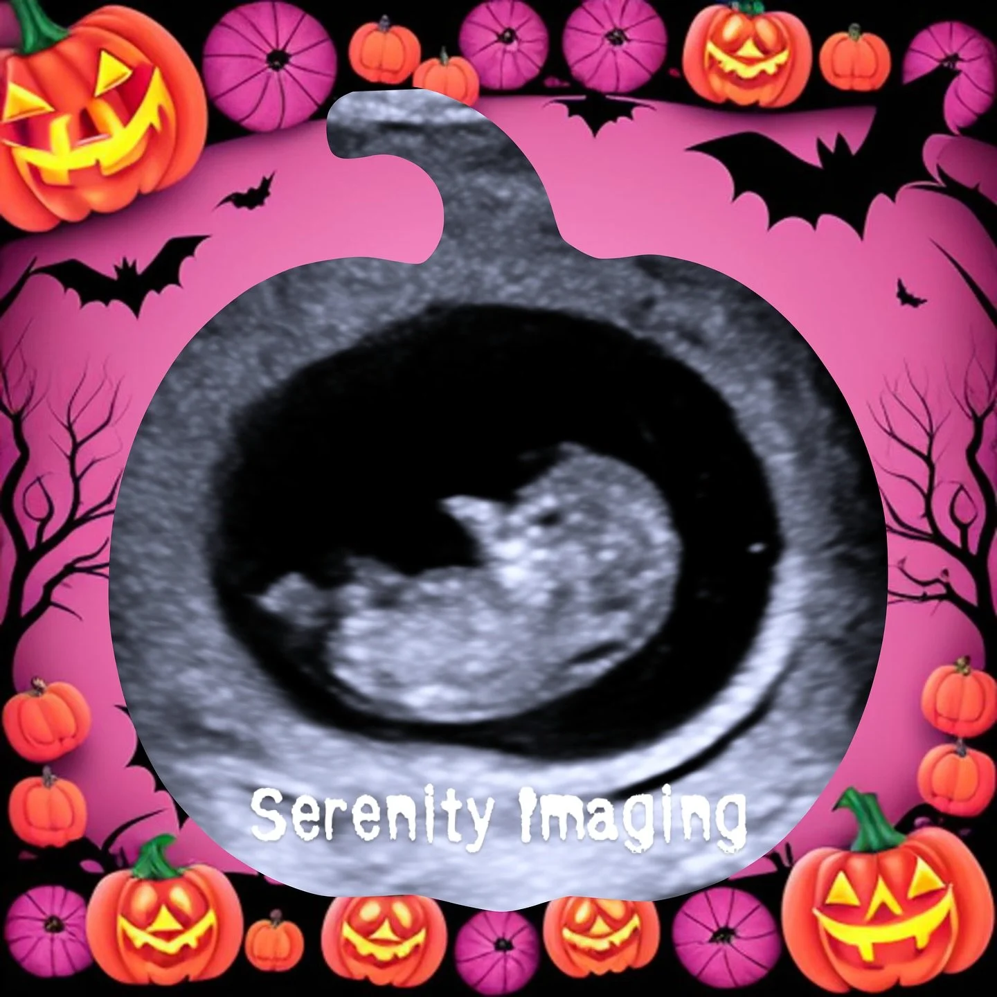 Halloween is coming and a baby pumpkin is growing 🎃👻

#halloween #halloweenbaby🎃 #ultrasound #1sttrimester