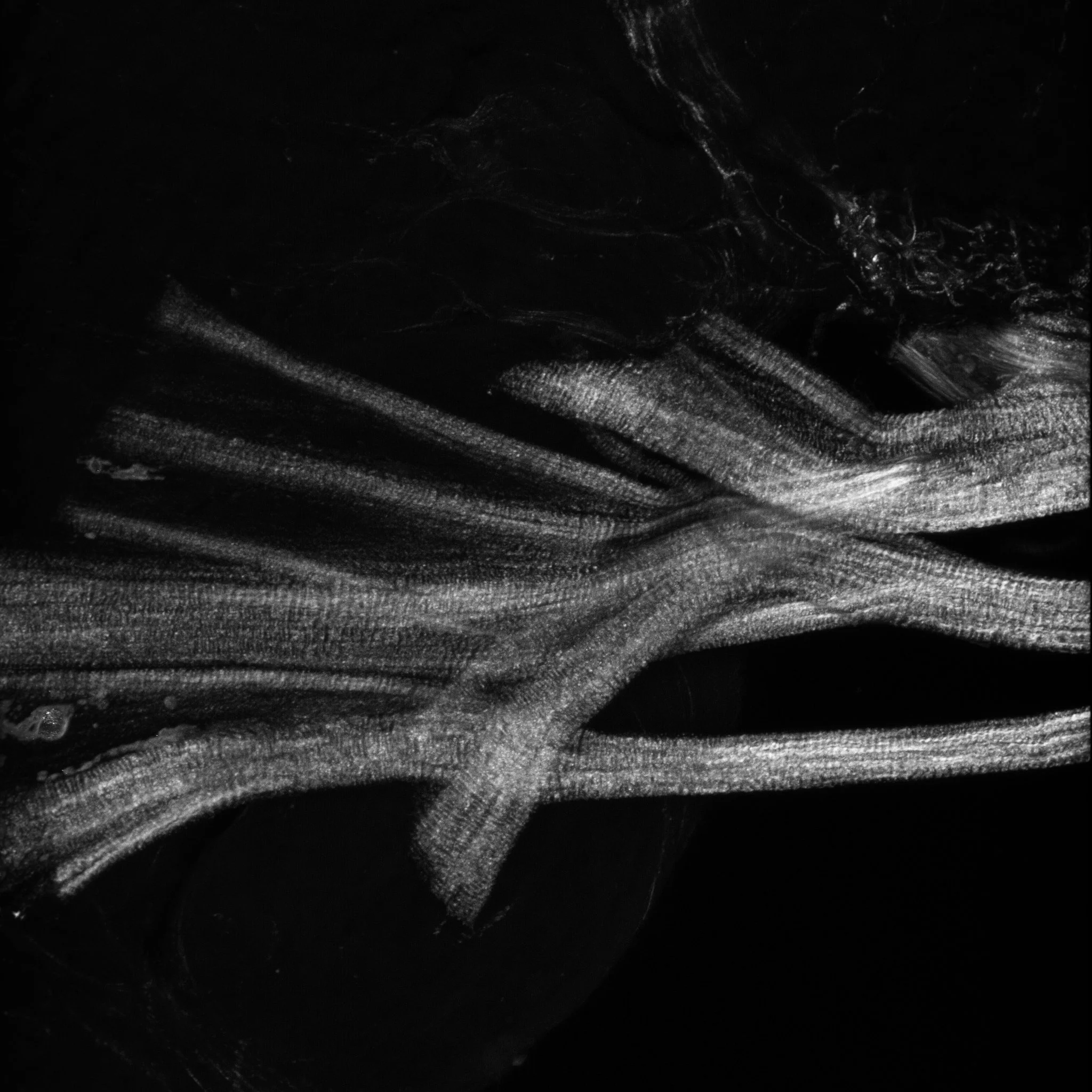 Tissue: Heart, Unstained for SHG