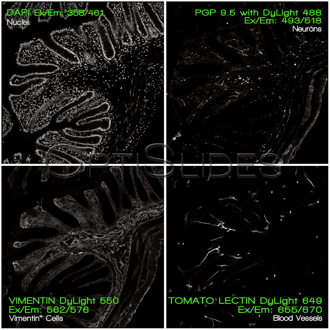 Mouse colon prepared slide — Optislides