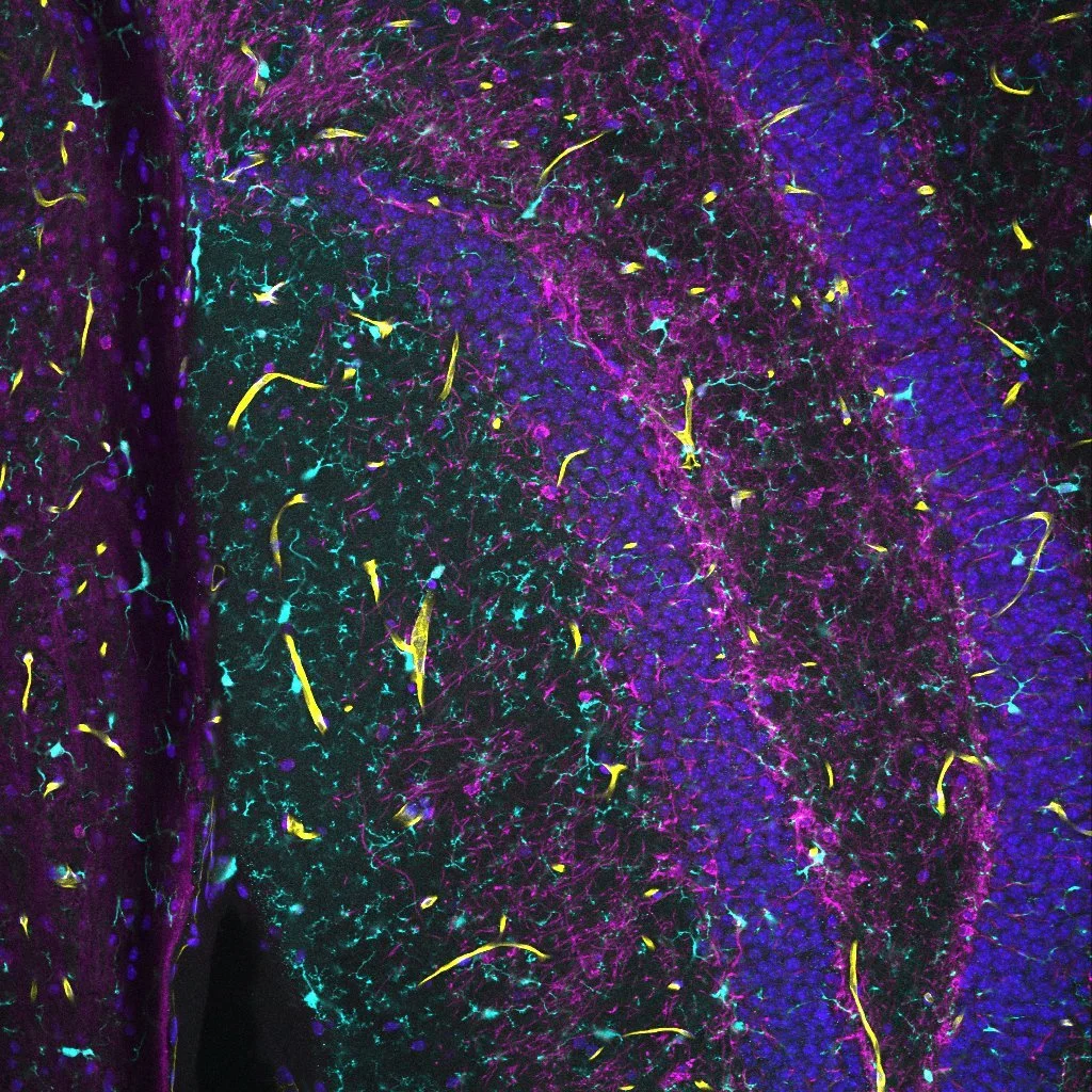 4C_20x_Brain_DIML_0002.jpg
