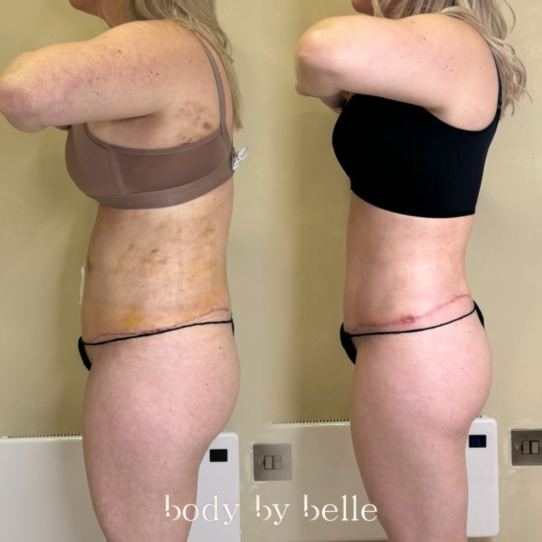 Untitled design - 1 (2).PNG