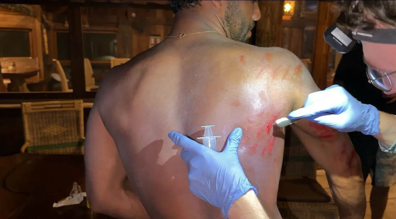Pro tip: always grab the pre-packed hotel toothbrushes for cleaning out reef rash. @hunterjoness for the footage and @lifeguardswb for the knowledge