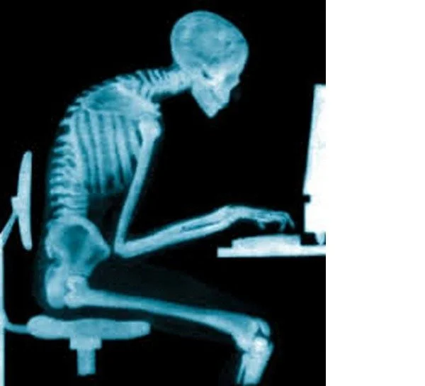 X-ray showing poor posture of a person slouched over a computer keyboard