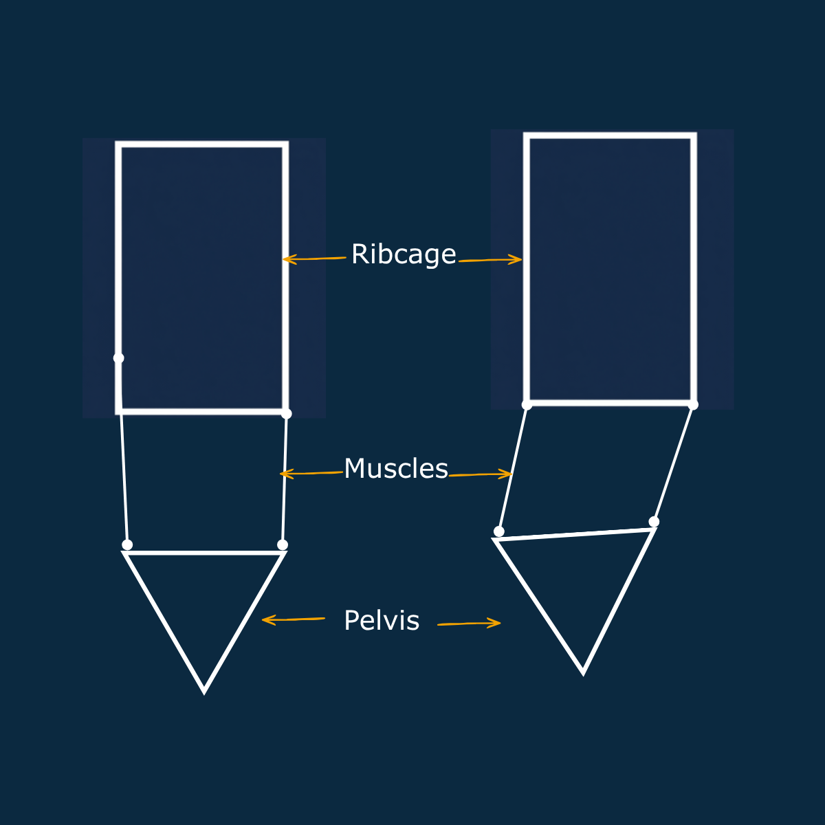 An image showing how differences in relative ribcage and pelvis positioning affects the muscles attaching to them